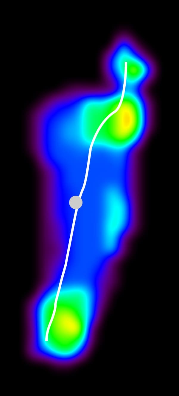 A pressure heatmap flatfoot example