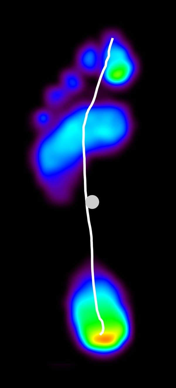 A pressure heatmap high-arch example
