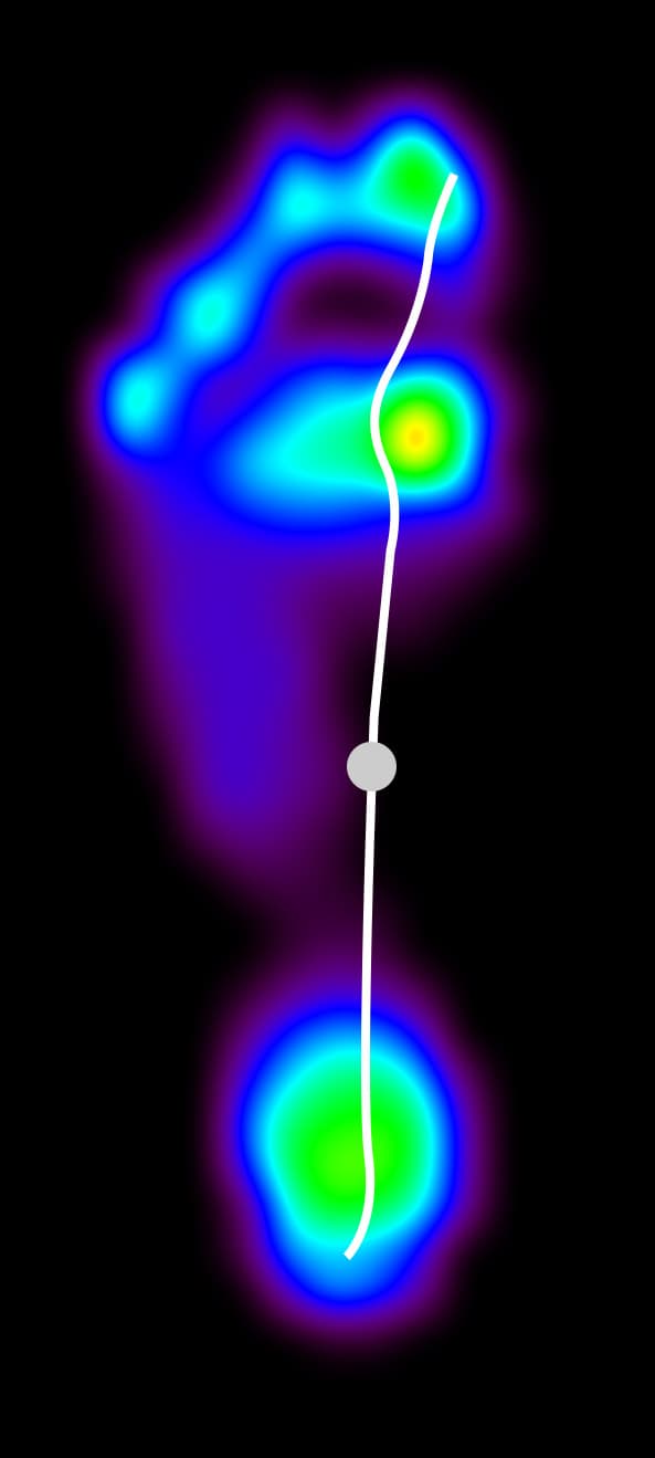 A pressure heatmap pes-valgus example
