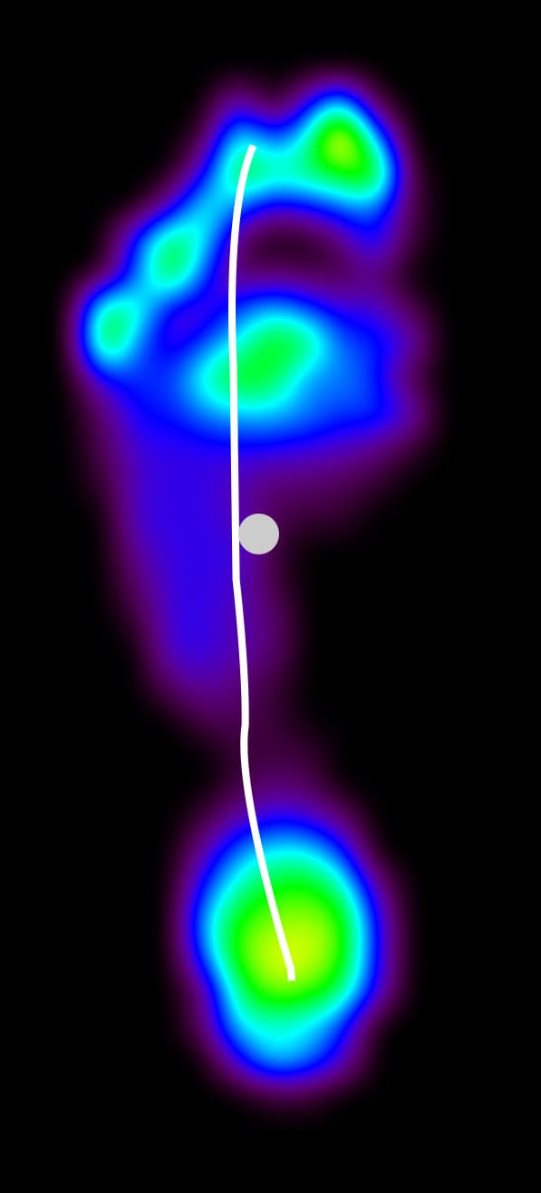 A pressure heatmap splay-foot example